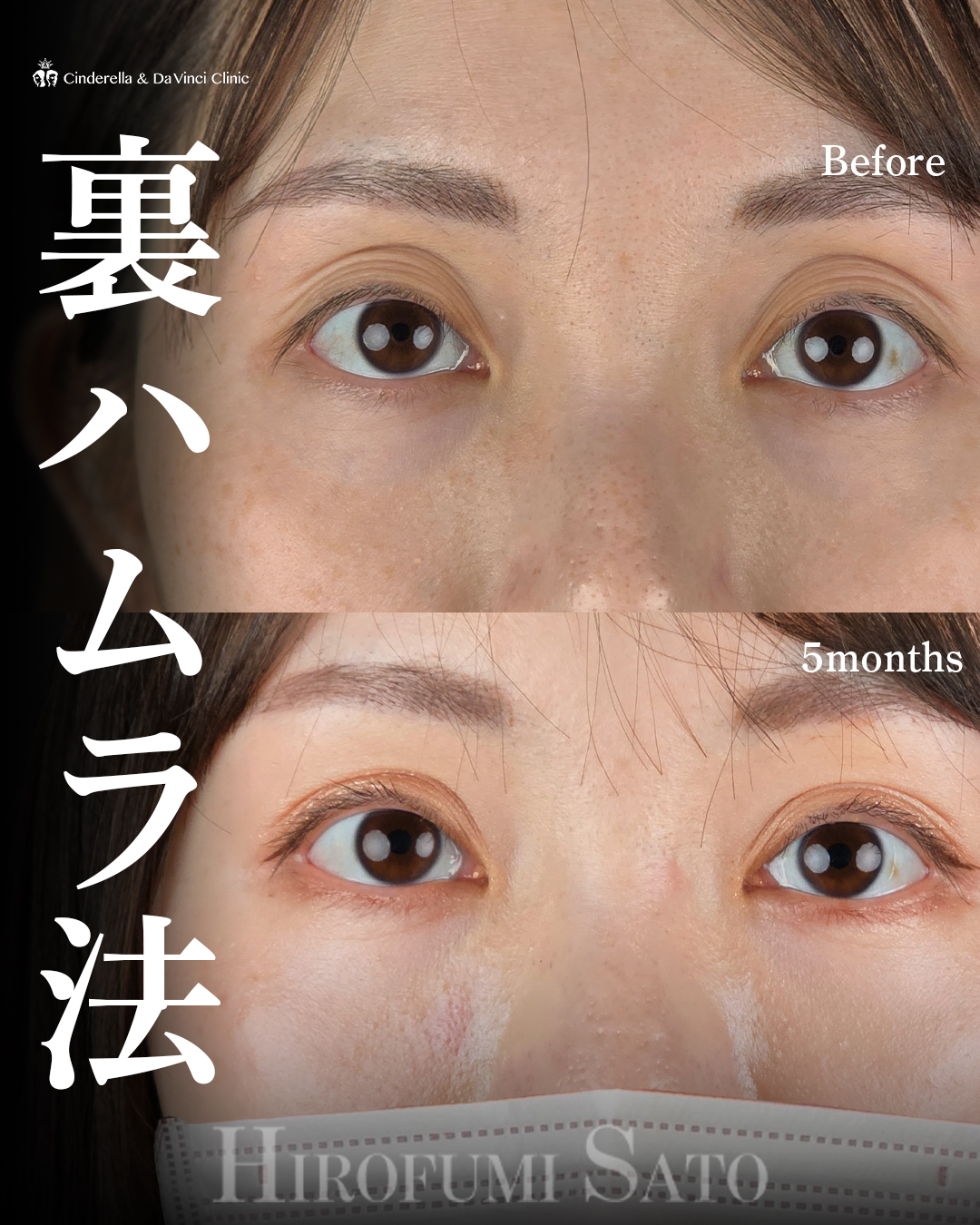 若々しいお目元にの画像