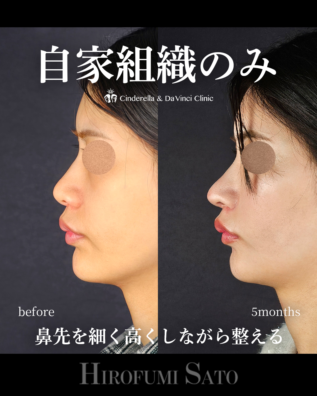 自家組織だけの画像