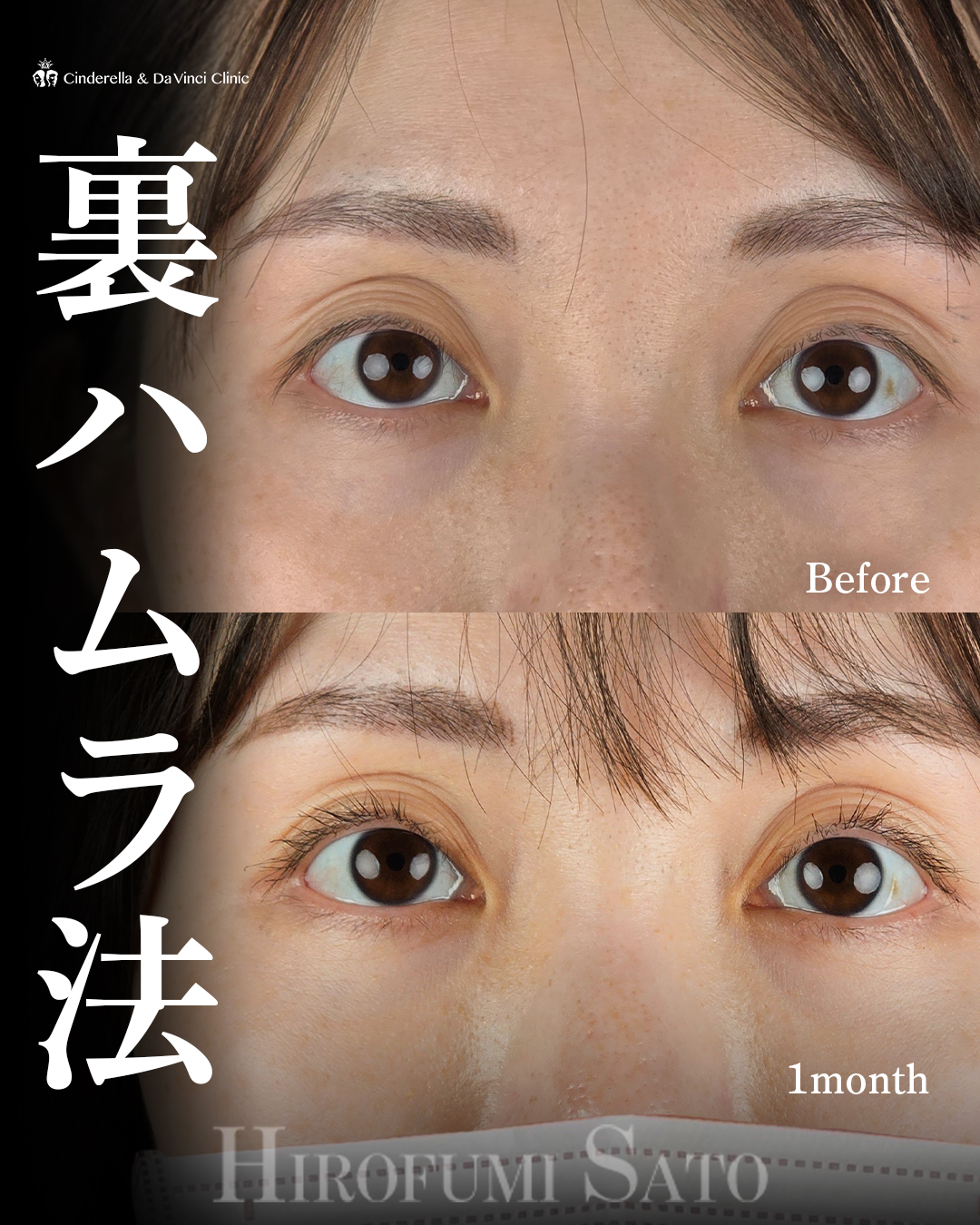 若々しいお目元にの画像