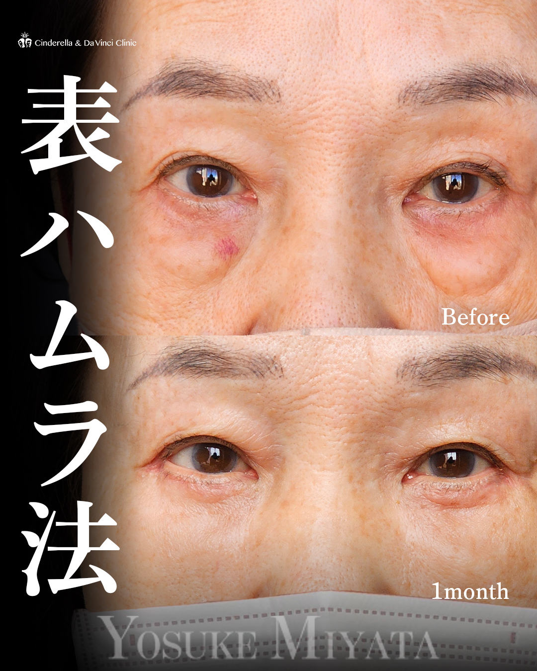 表ハムラで若々しくの画像