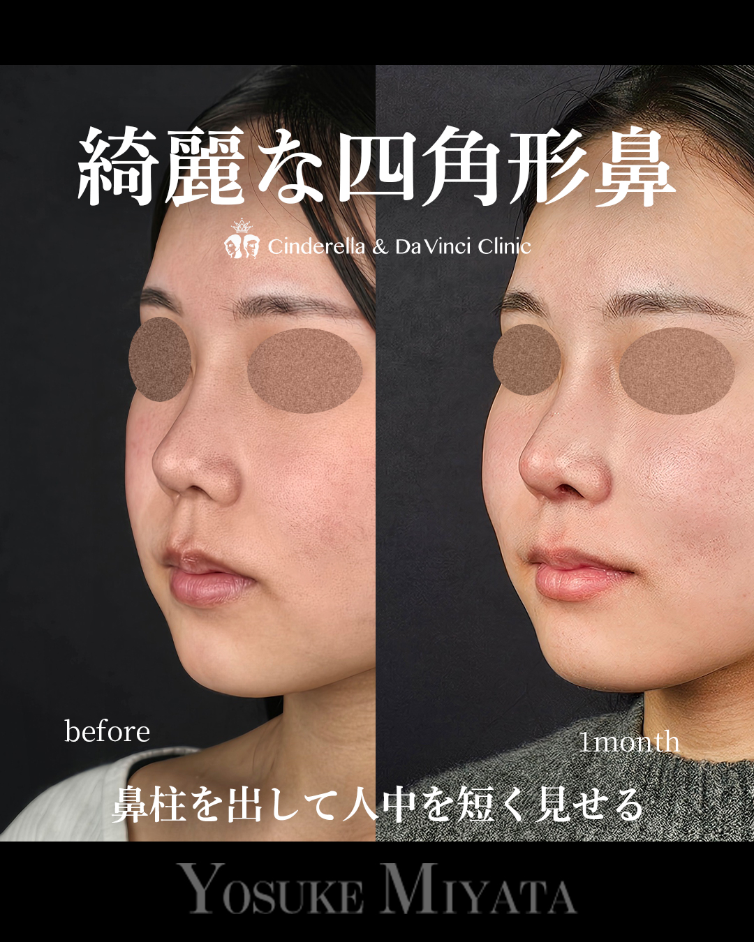 綺麗な四角形鼻の画像