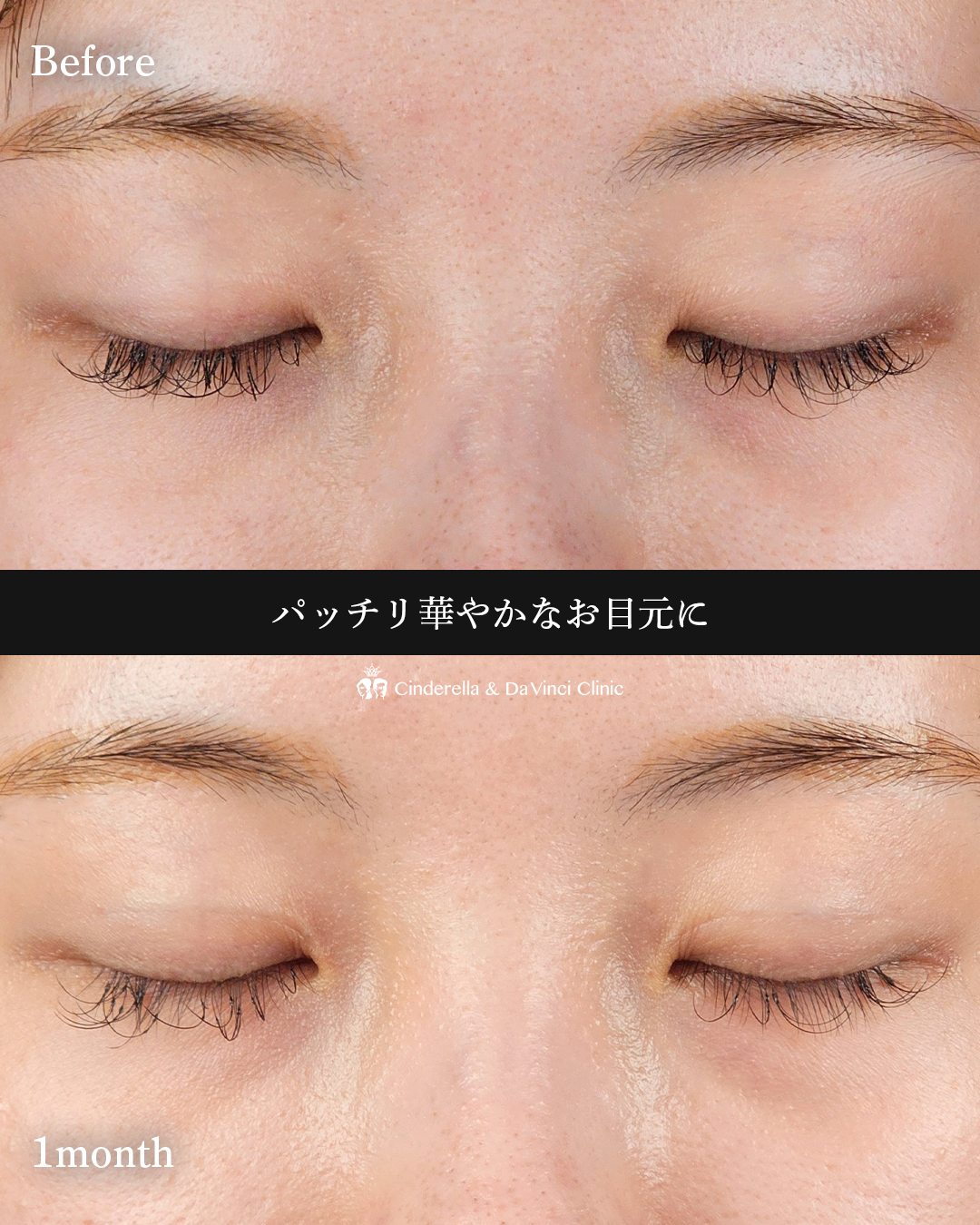 華やか二重にの画像