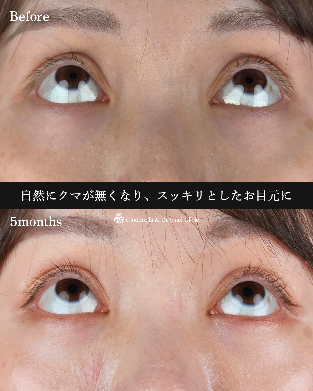 若々しいお目元にの画像