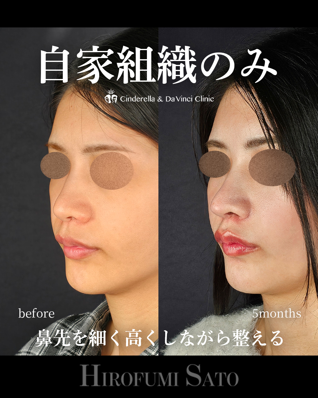 自家組織だけの画像