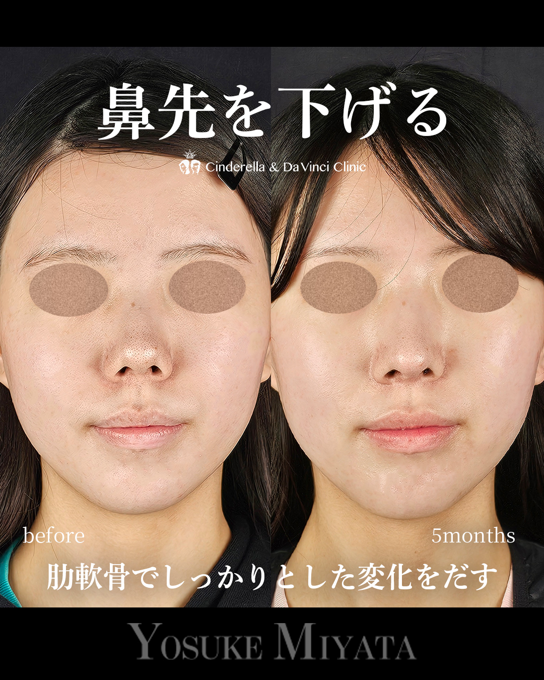 鼻先を下げるの画像