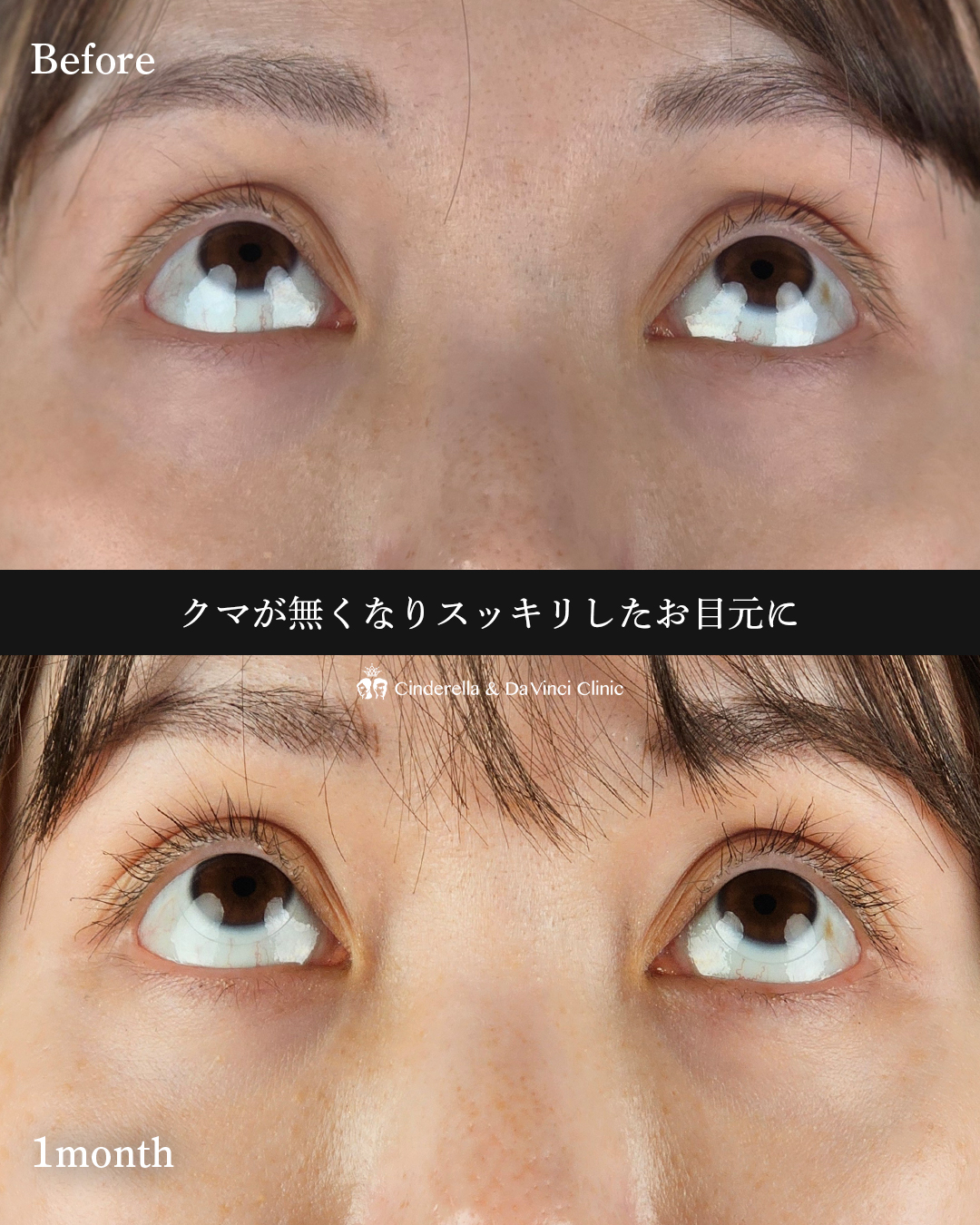 若々しいお目元にの画像