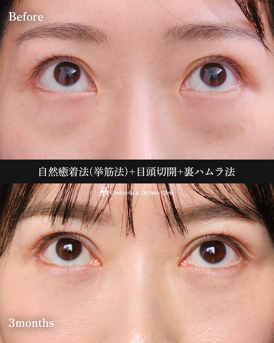 三施術同時の画像