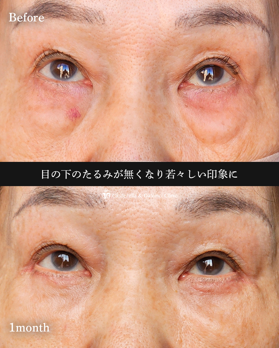 表ハムラで若々しくの画像