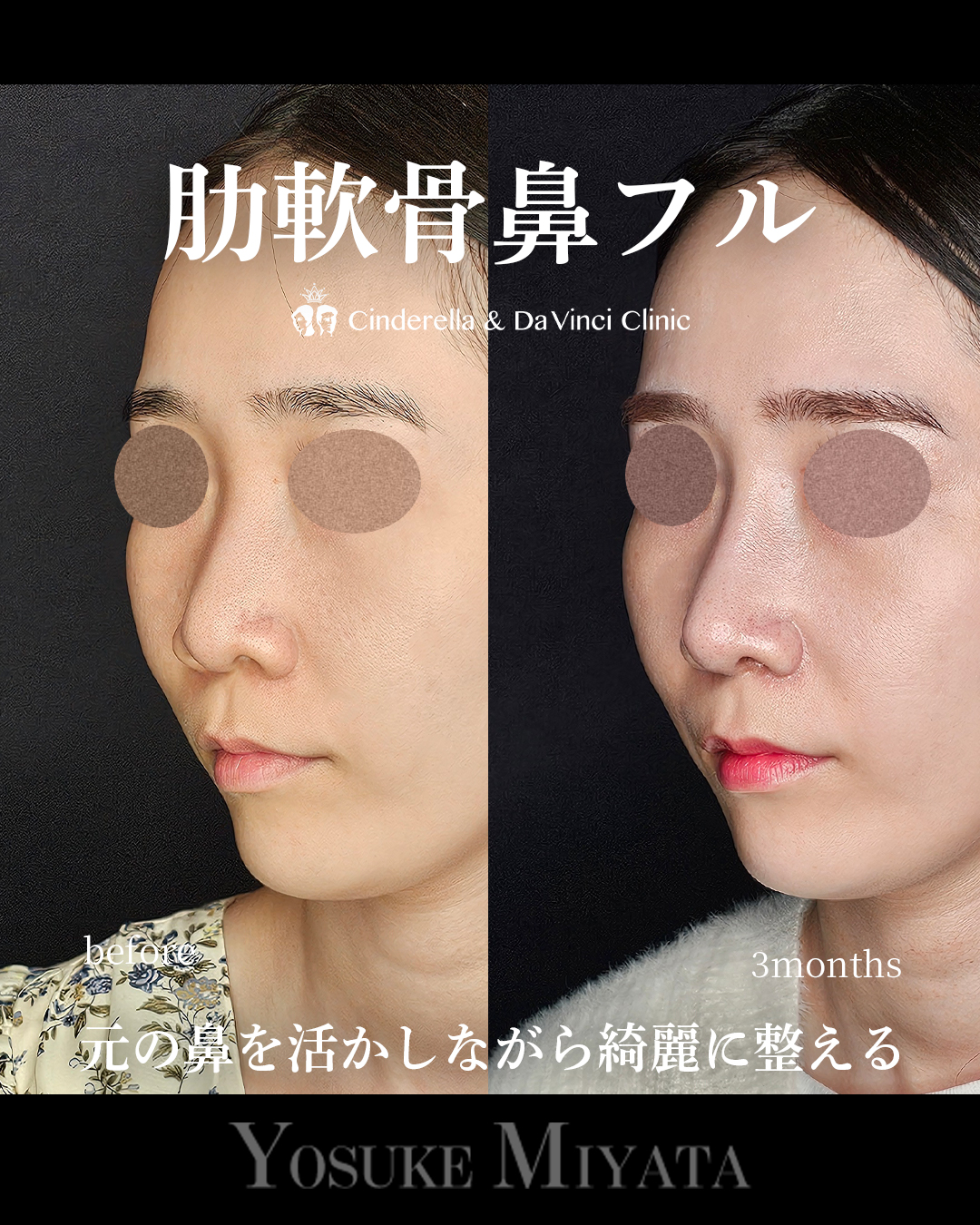 ナチュラルアプデの画像