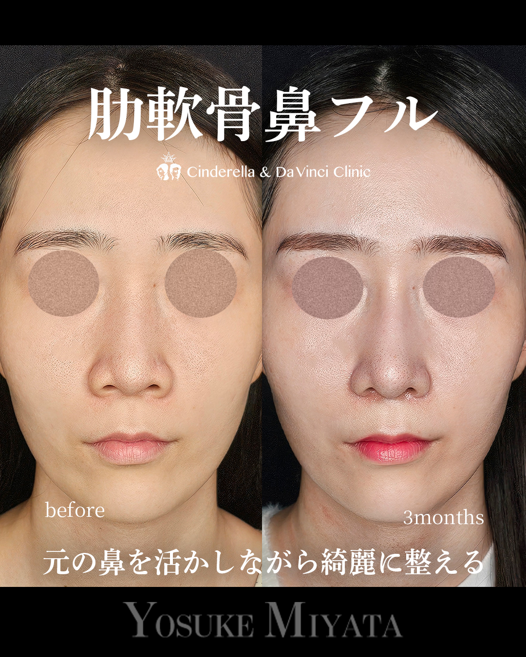 ナチュラルアプデの画像