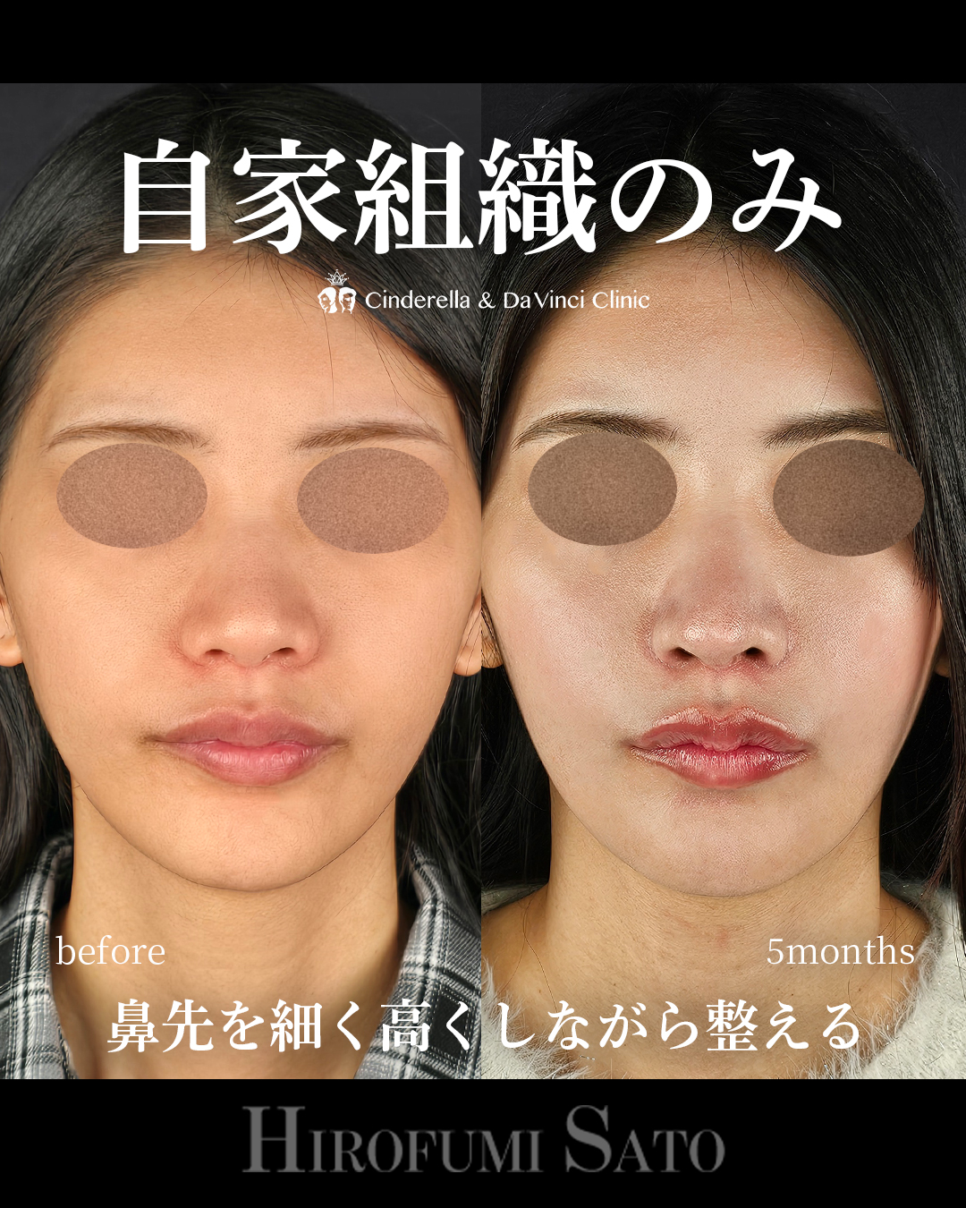 自家組織だけの画像