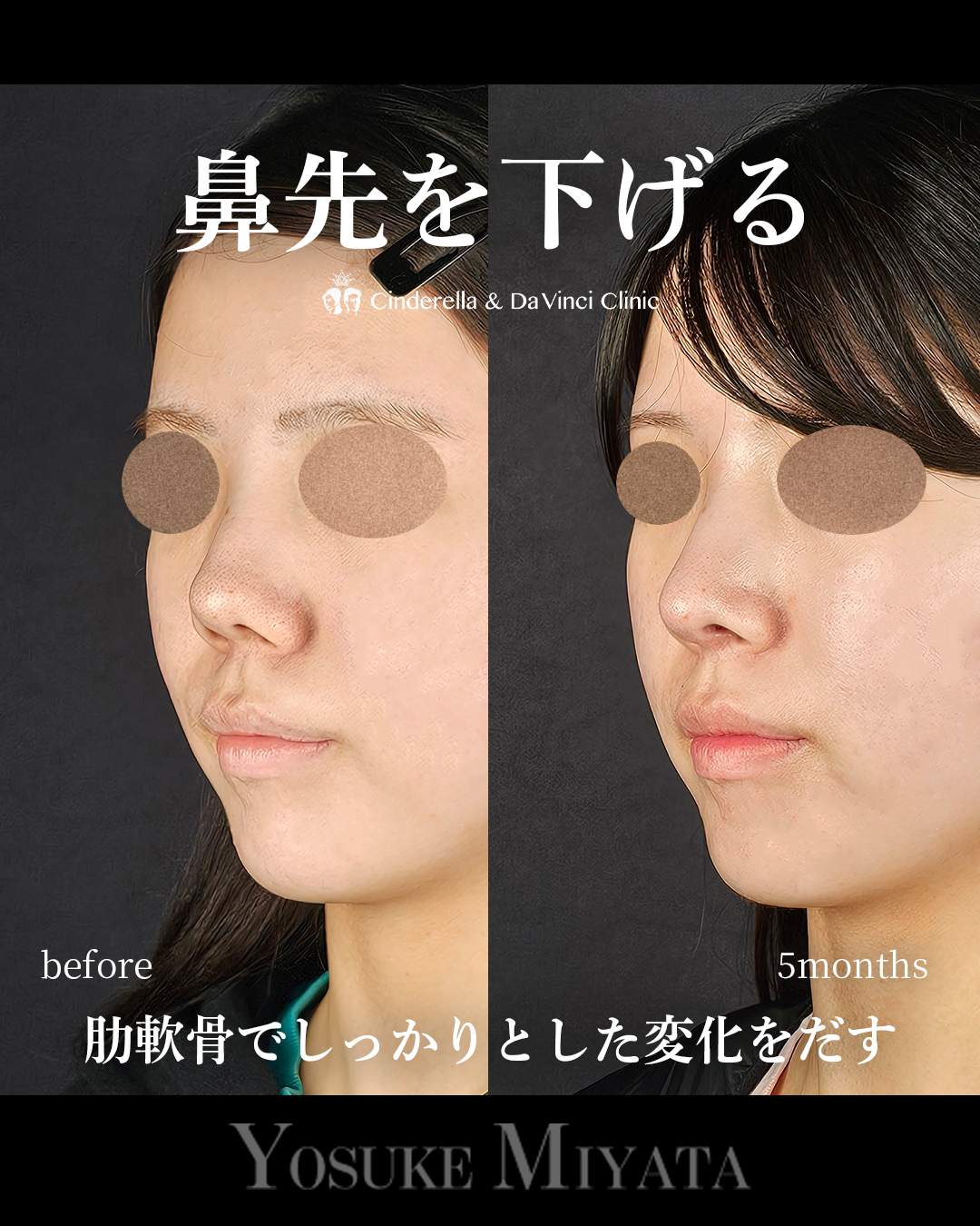 鼻先を下げるの画像