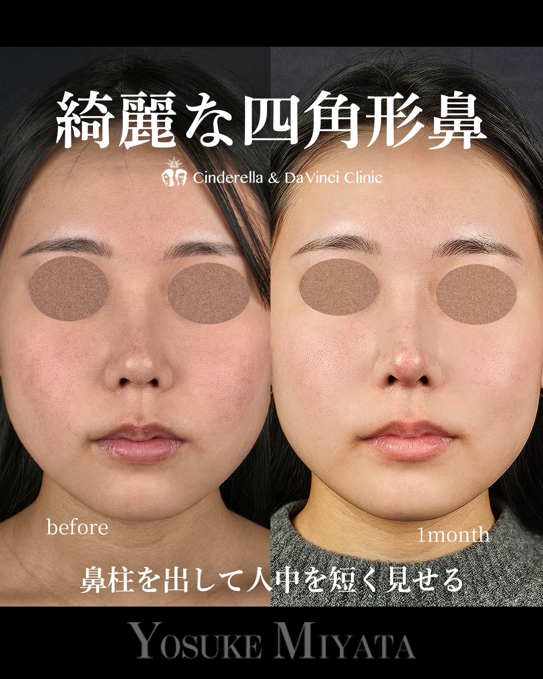 綺麗な四角形鼻の画像