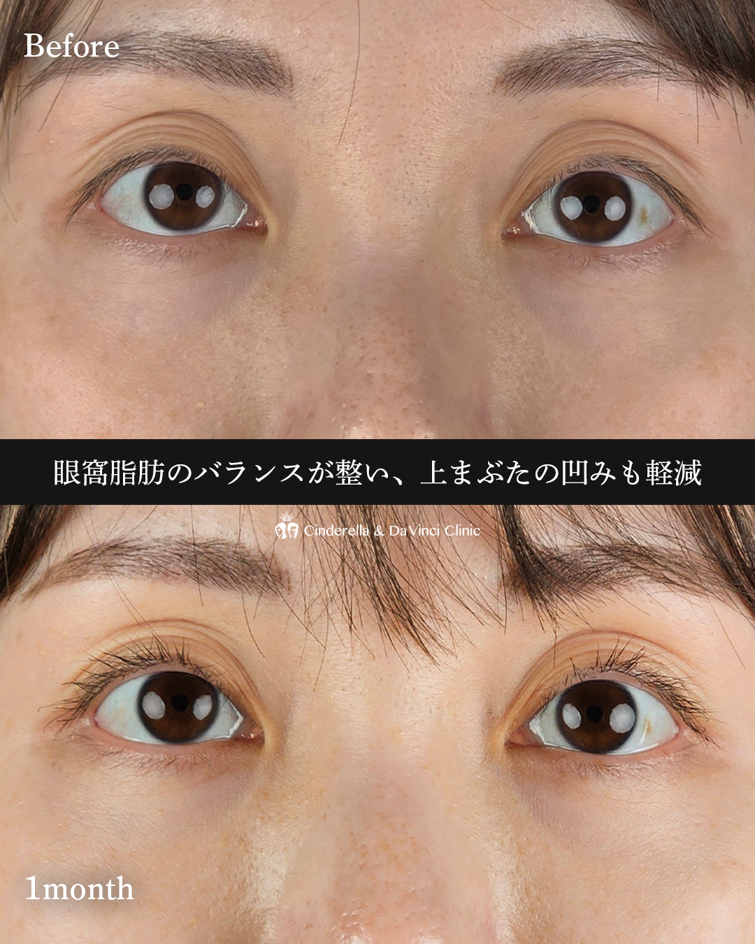 若々しいお目元にの画像