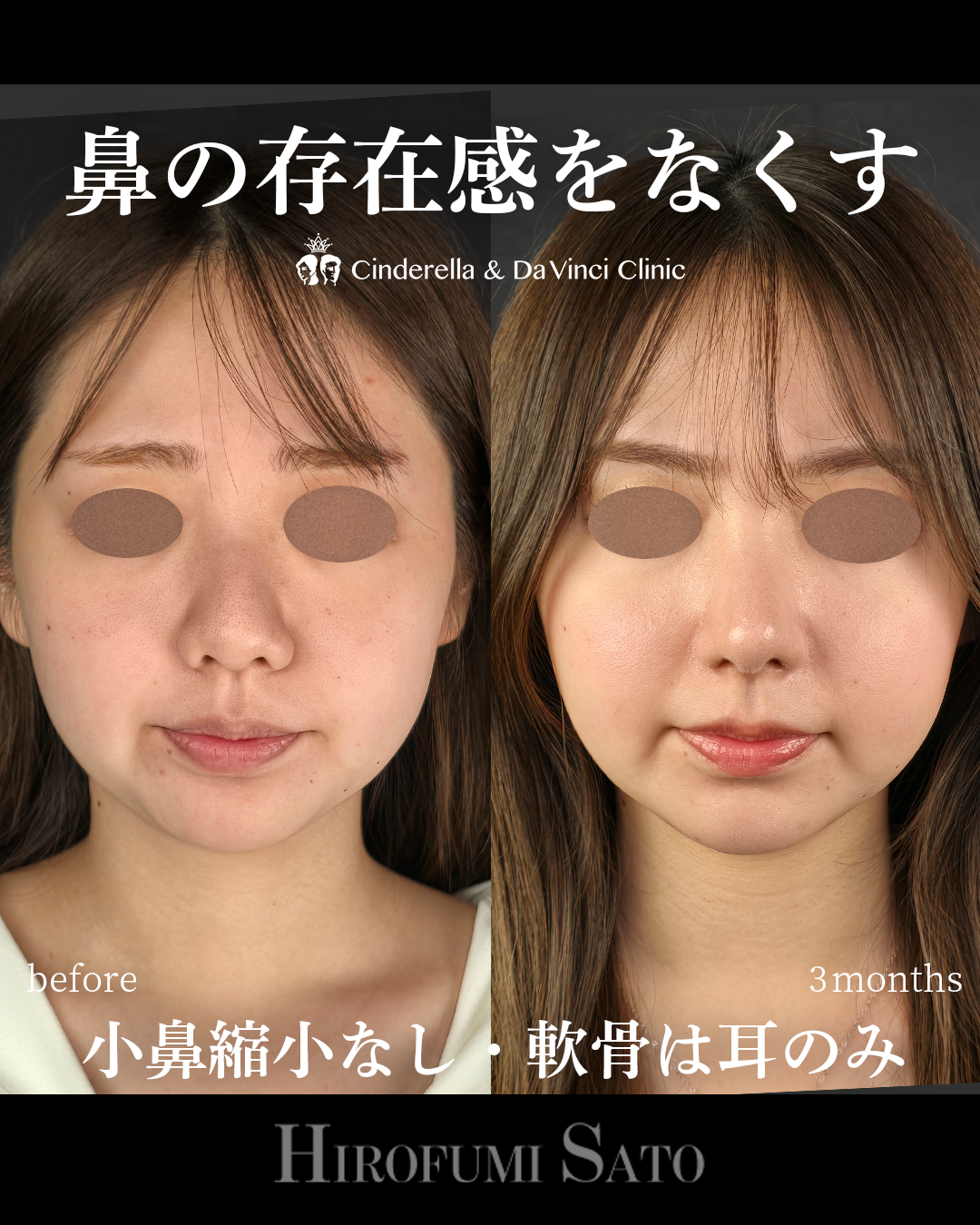 鼻の存在感をなくすの画像