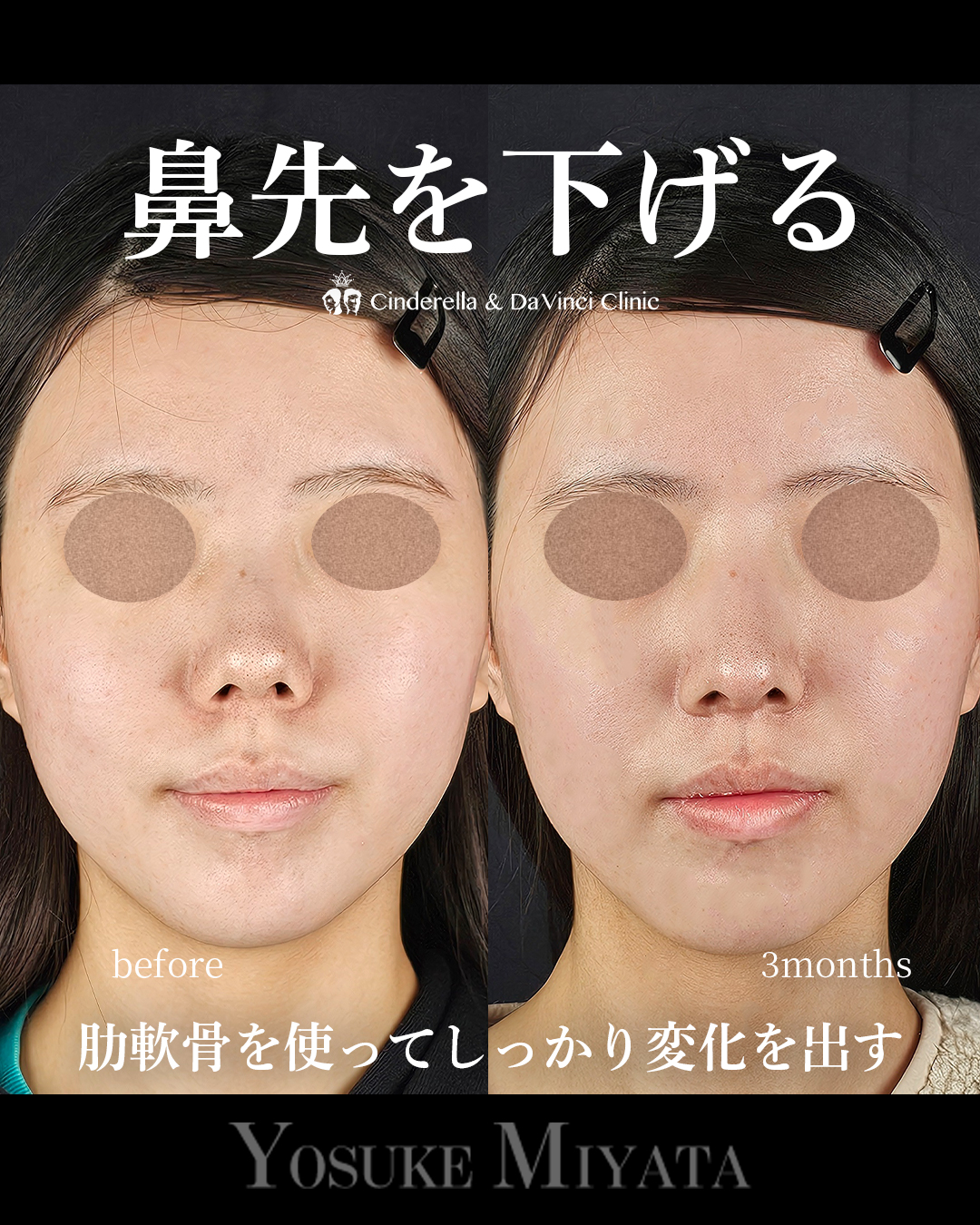 鼻先を下げるの画像