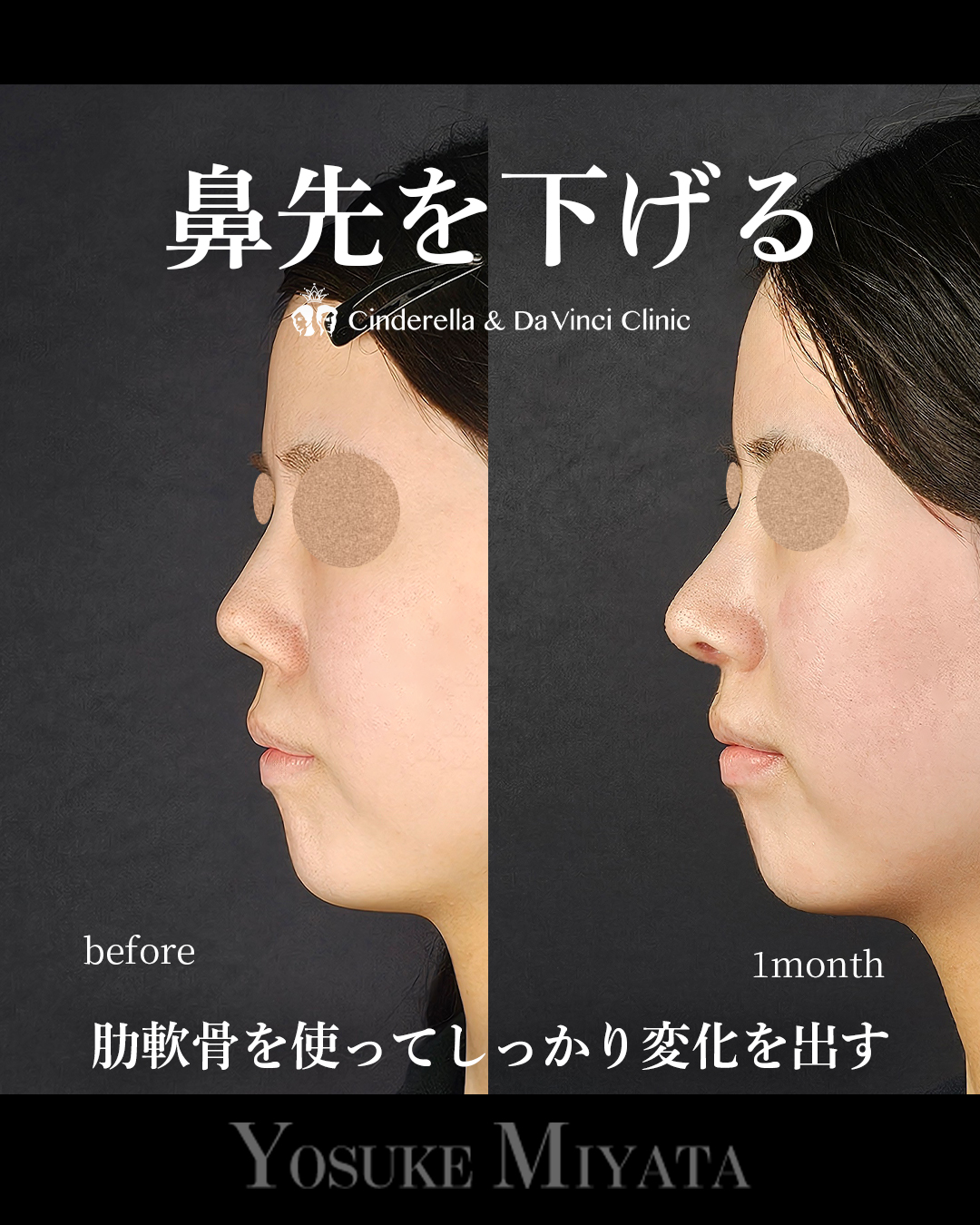 鼻先を下げるの画像