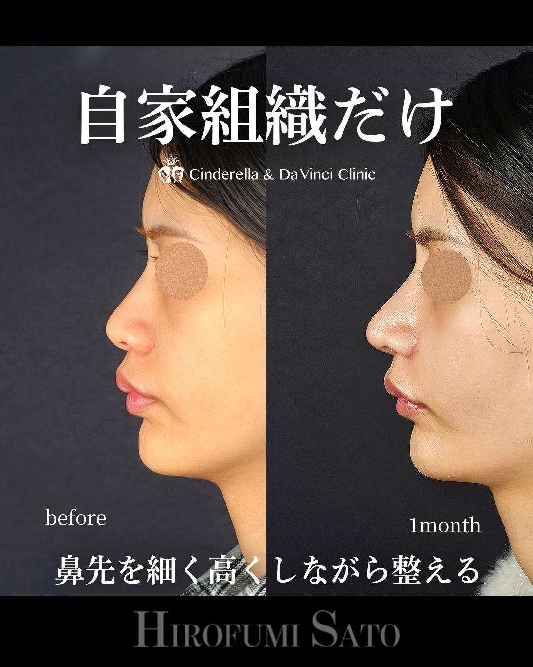 自家組織だけの画像