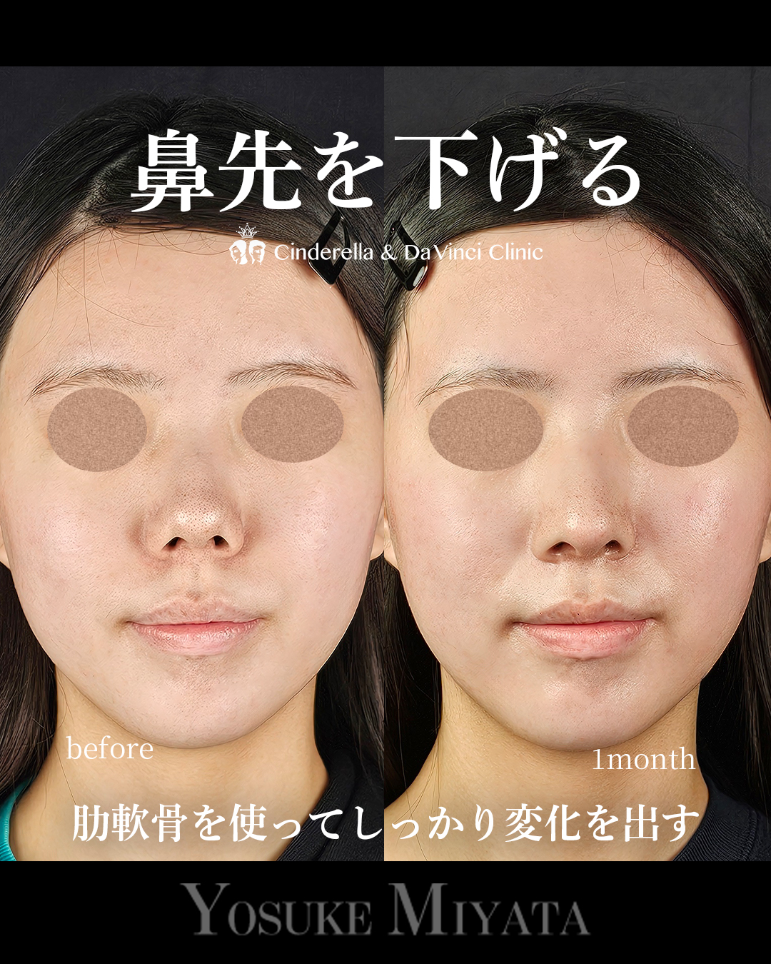 鼻先を下げるの画像