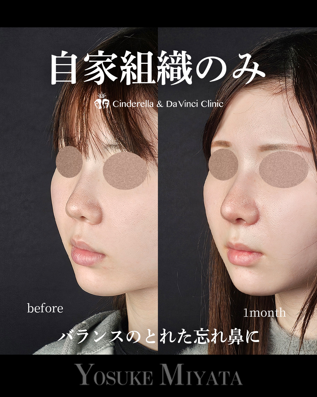 自家組織のみの画像