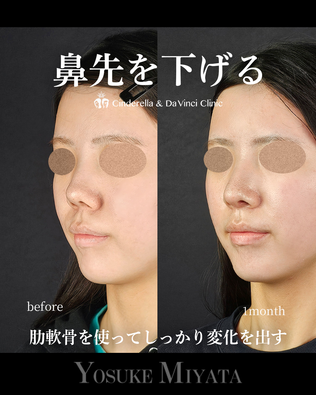 鼻先を下げるの画像