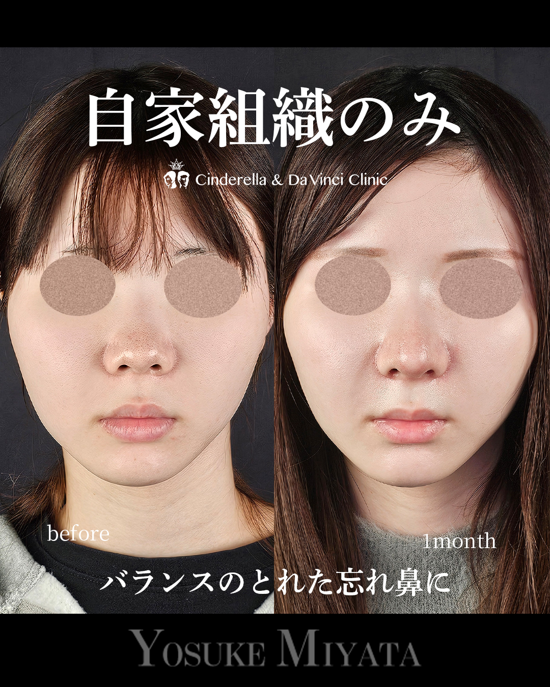 自家組織のみの画像