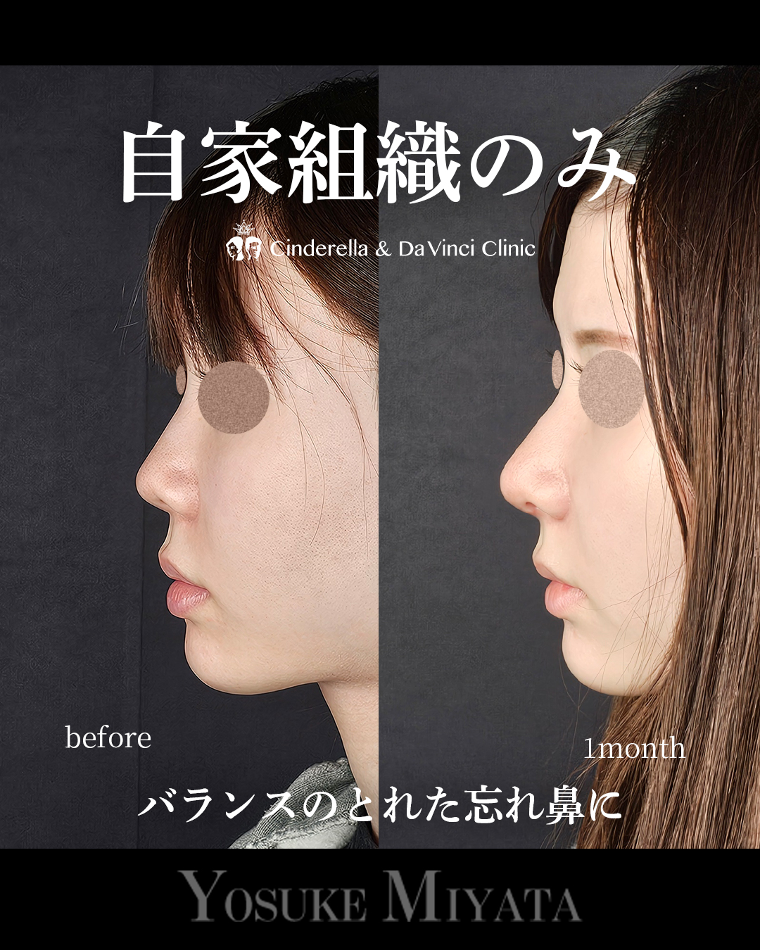 自家組織のみの画像