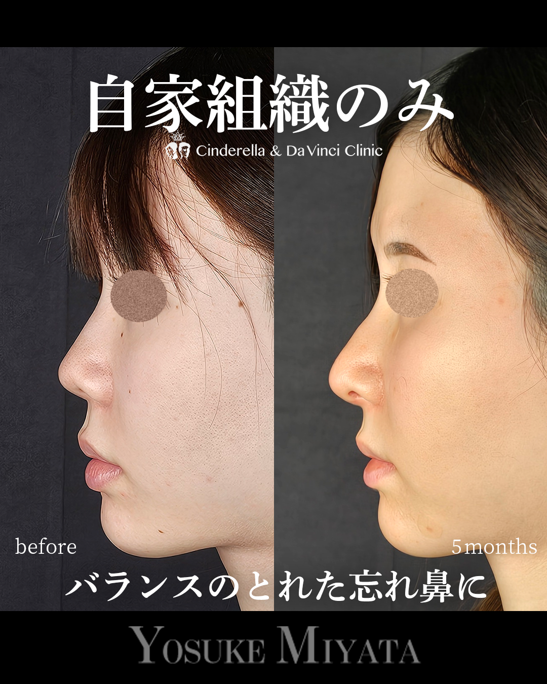 自家組織のみの画像