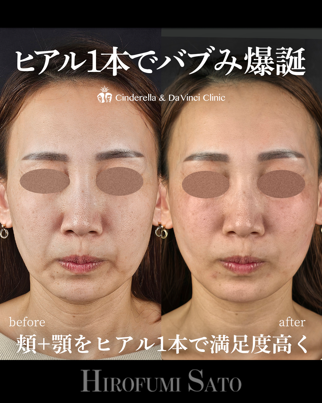 ヒアル1本でバブみ爆誕の画像