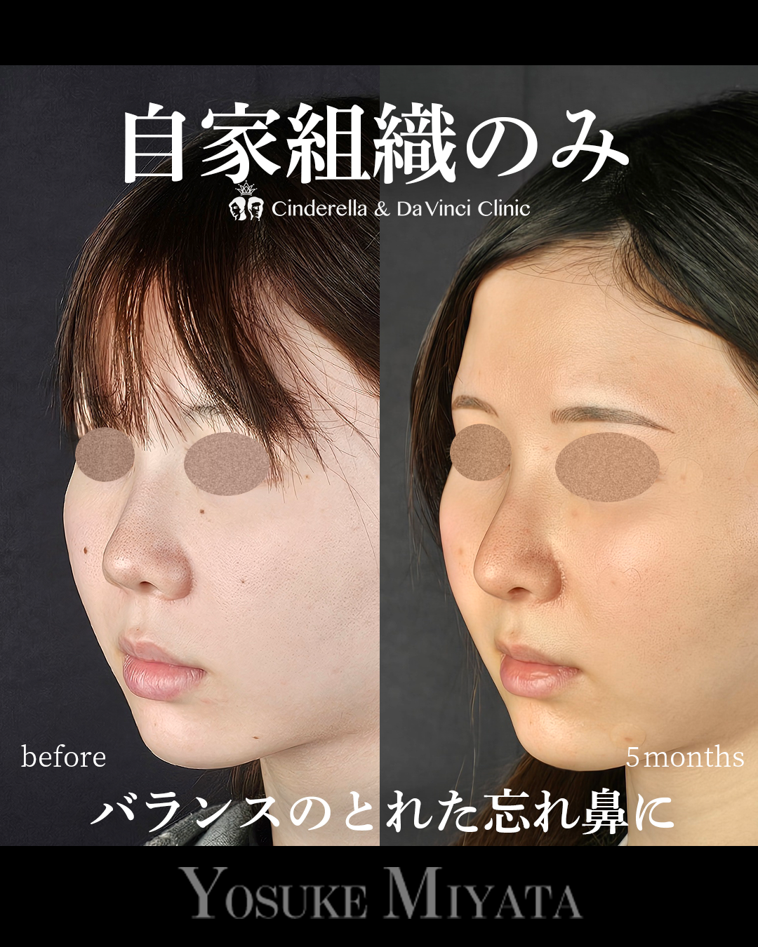 自家組織のみの画像