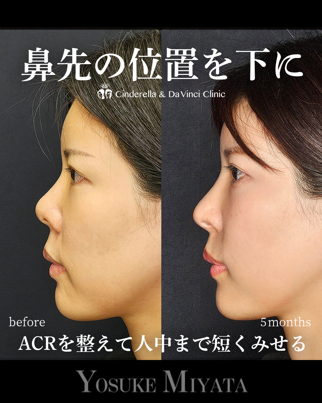 鼻先の位置を下にするの画像