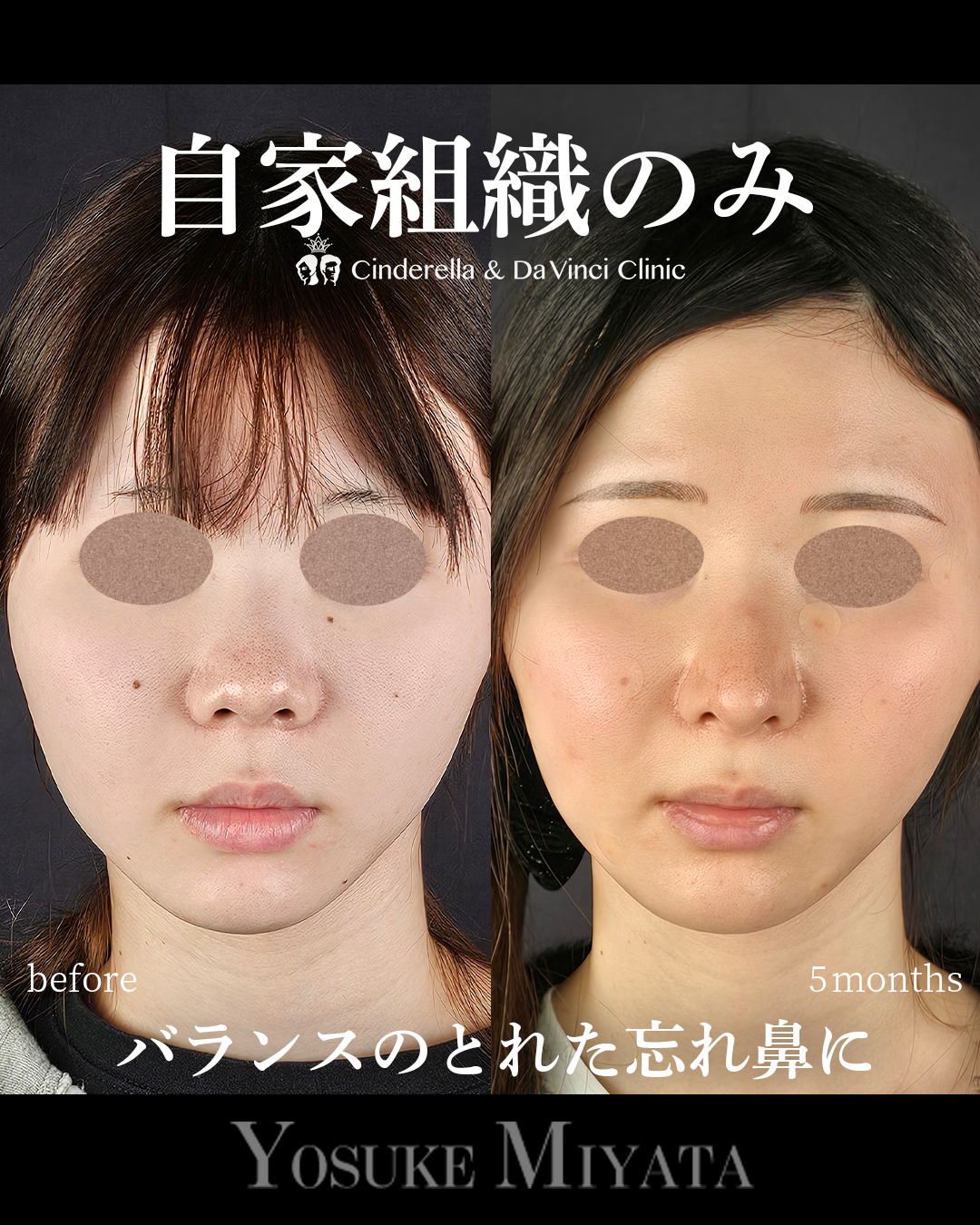 自家組織のみの画像