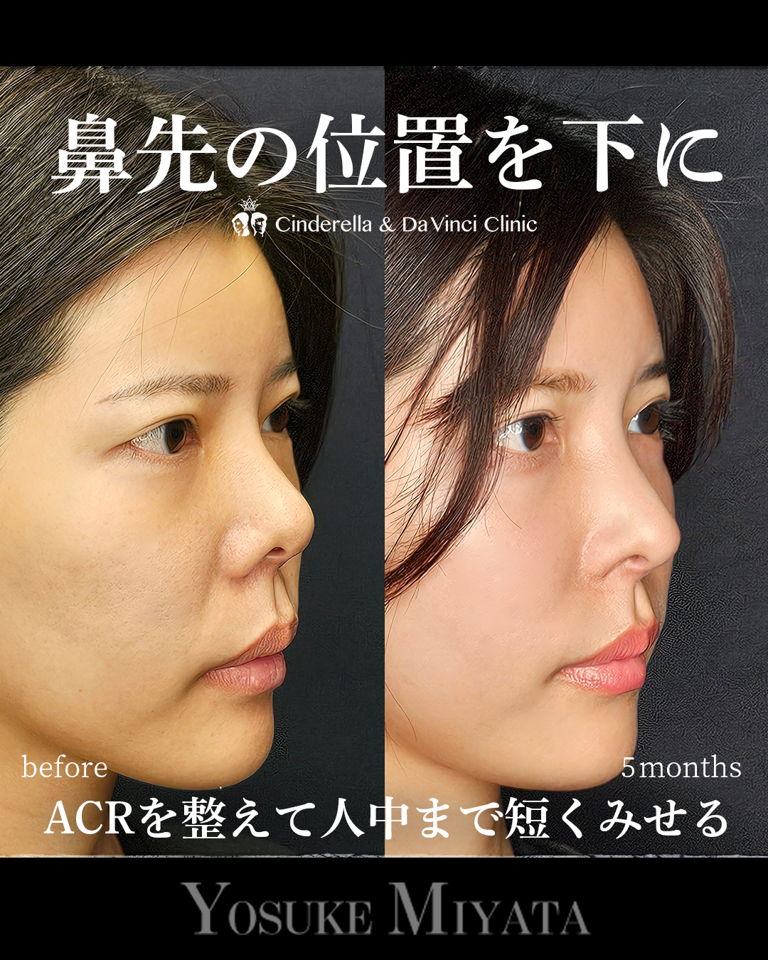 鼻先の位置を下にするの画像