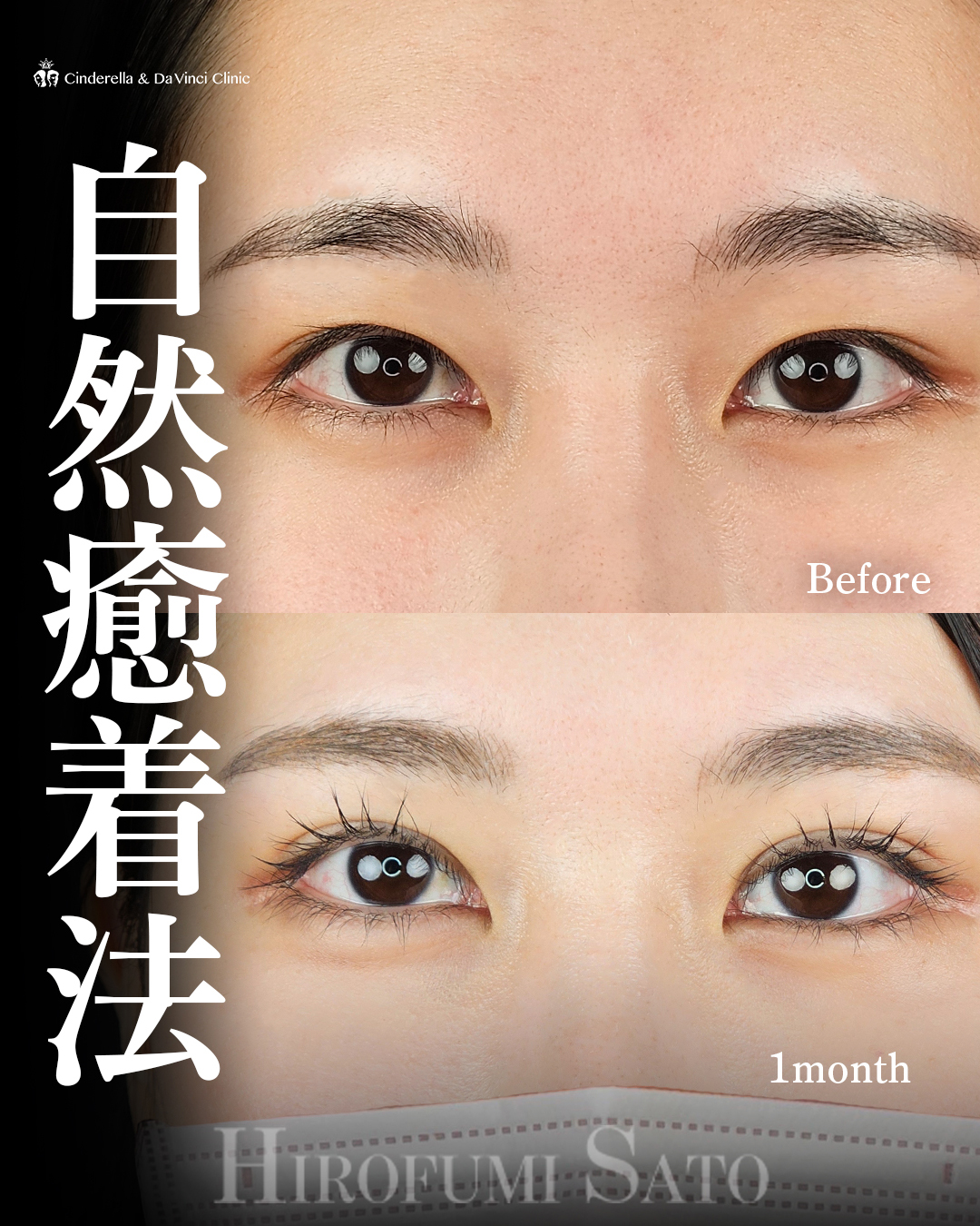 自然であり華やかな目の画像