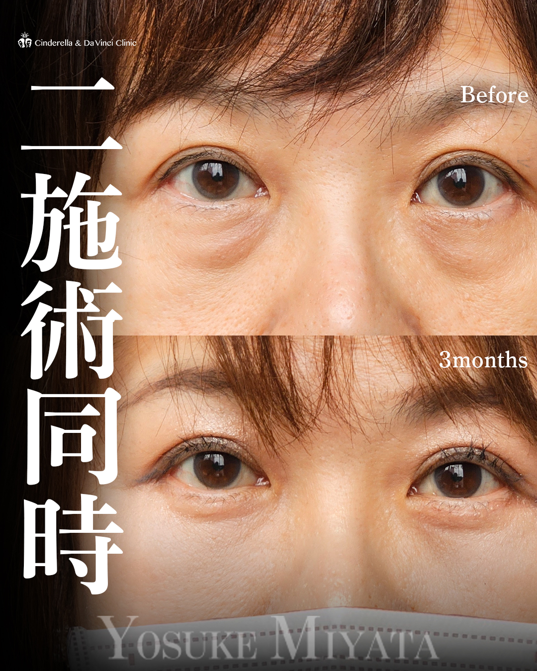 二施術同時の画像