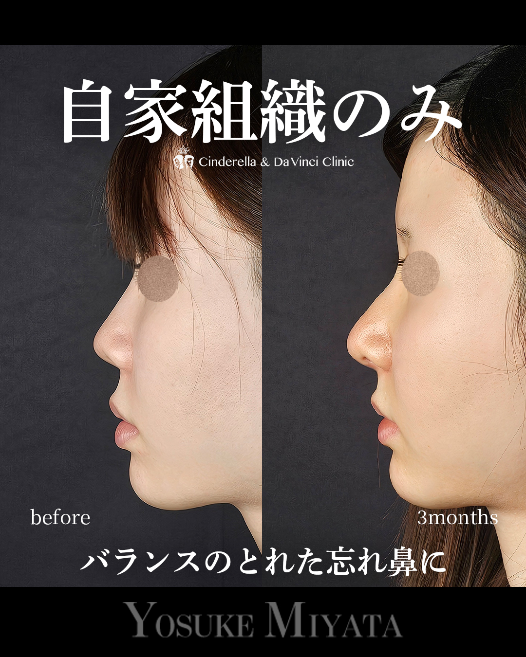 自家組織のみの画像