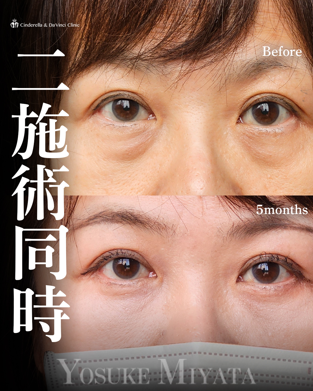 二施術同時の画像