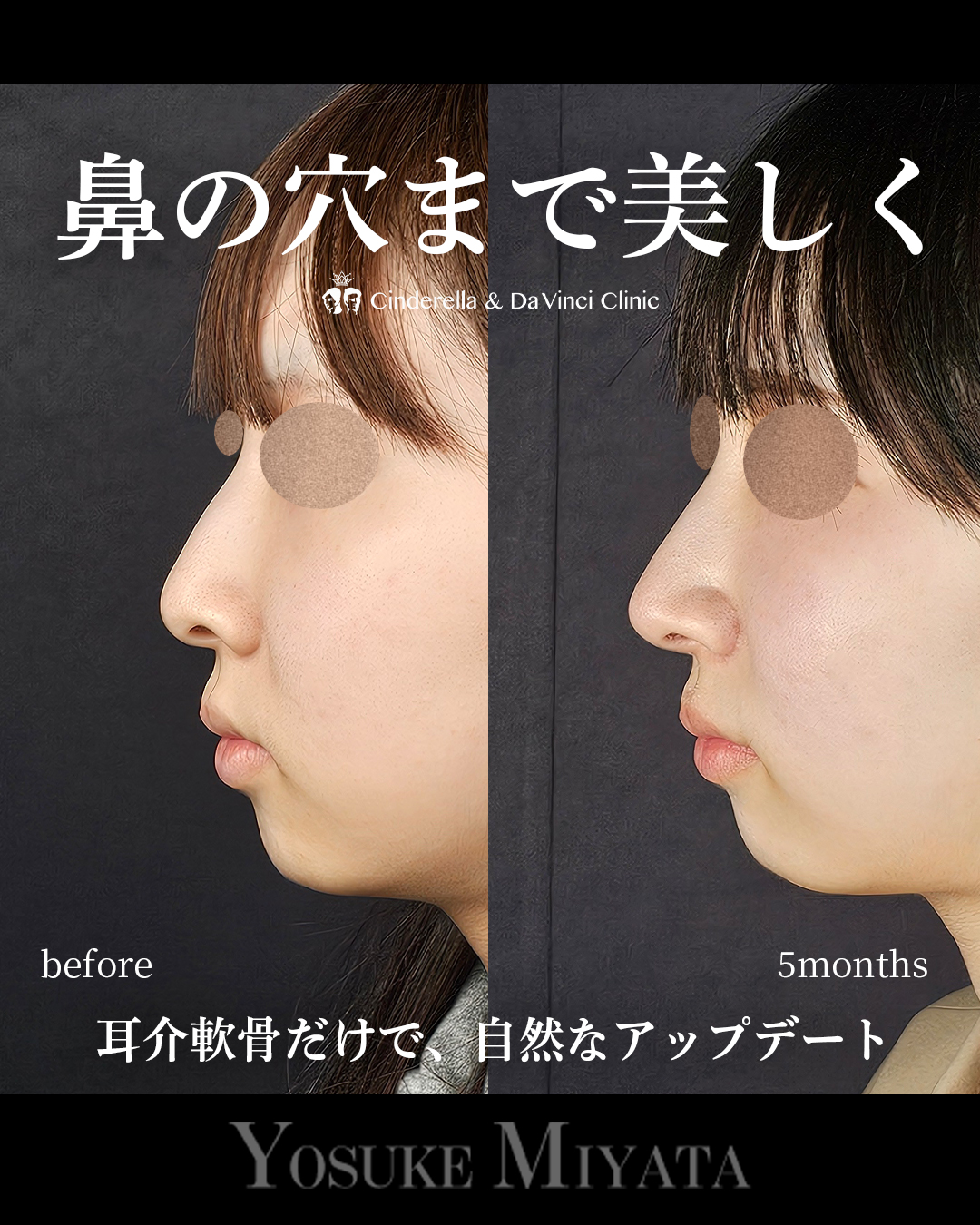 鼻の穴まできれいにの画像