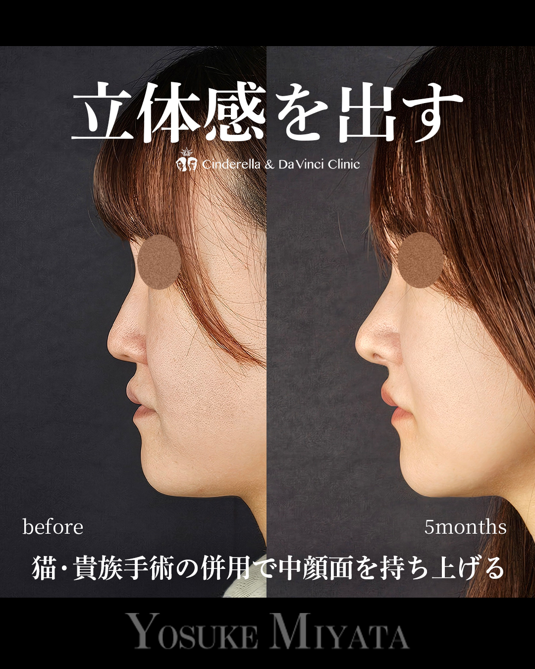 立体感を出すの画像