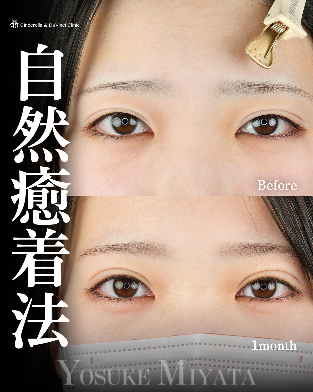 平行二重で華やかに