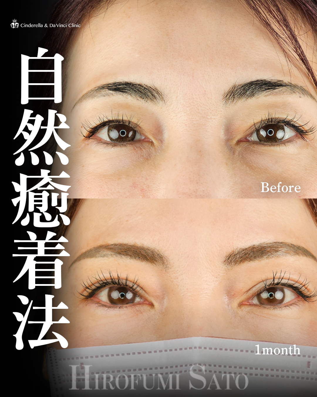 左右差改善の画像