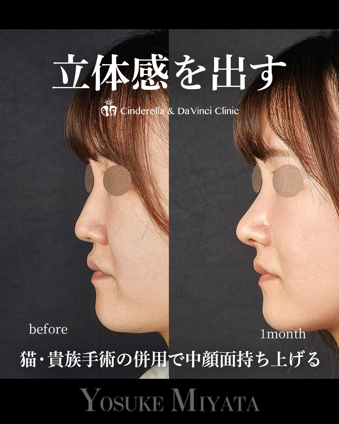 立体感を出すの画像