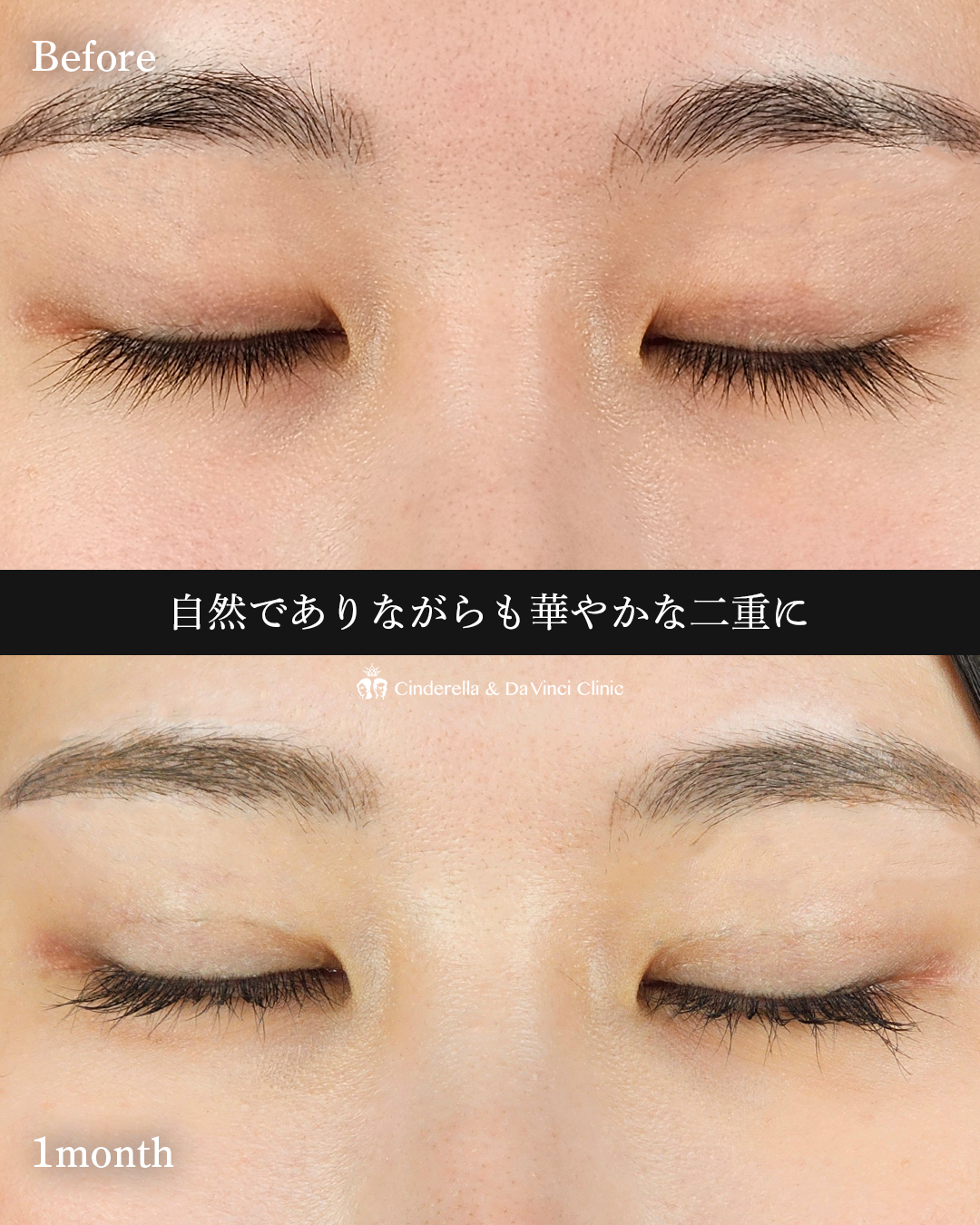 自然であり華やかな目の画像