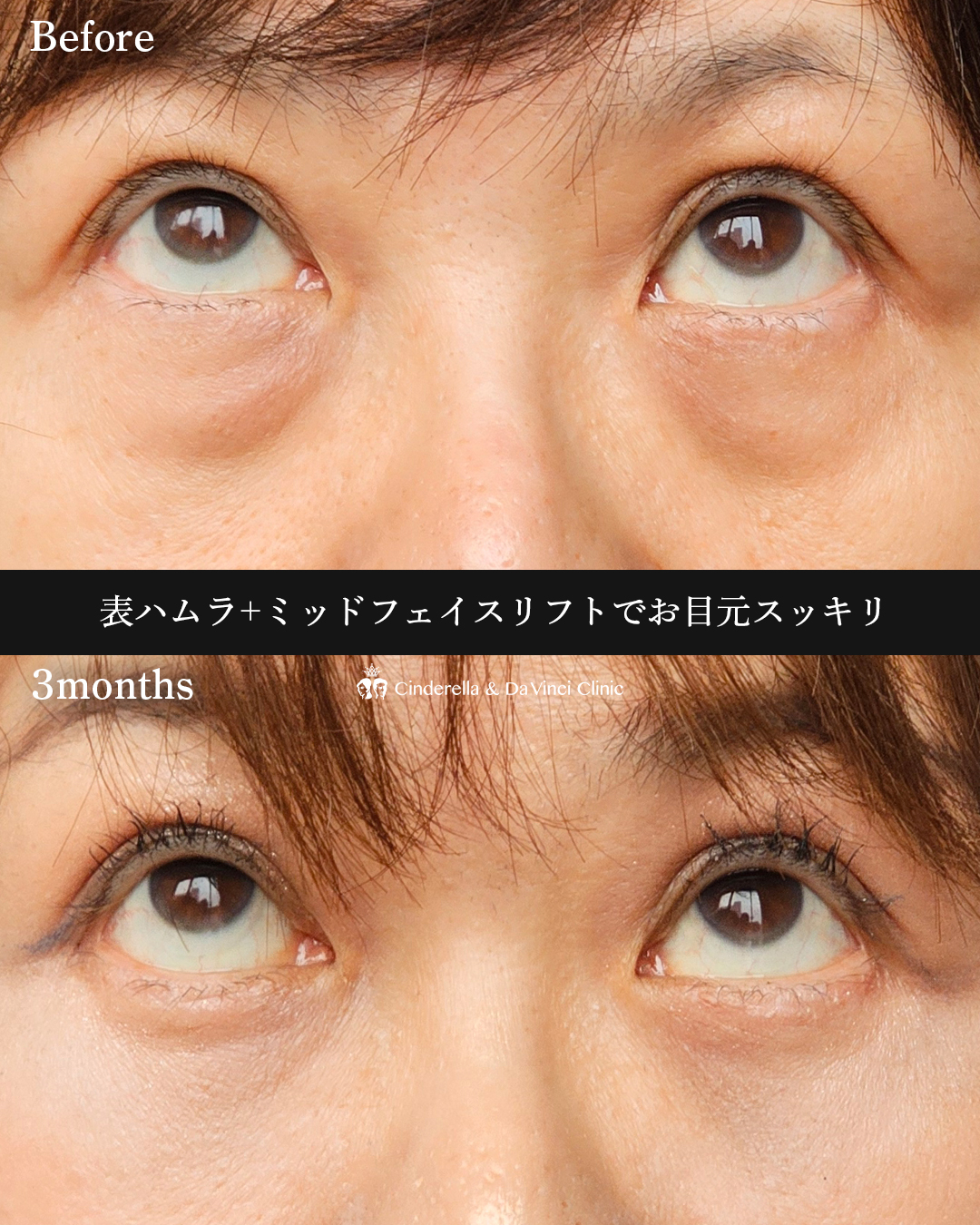 二施術同時の画像