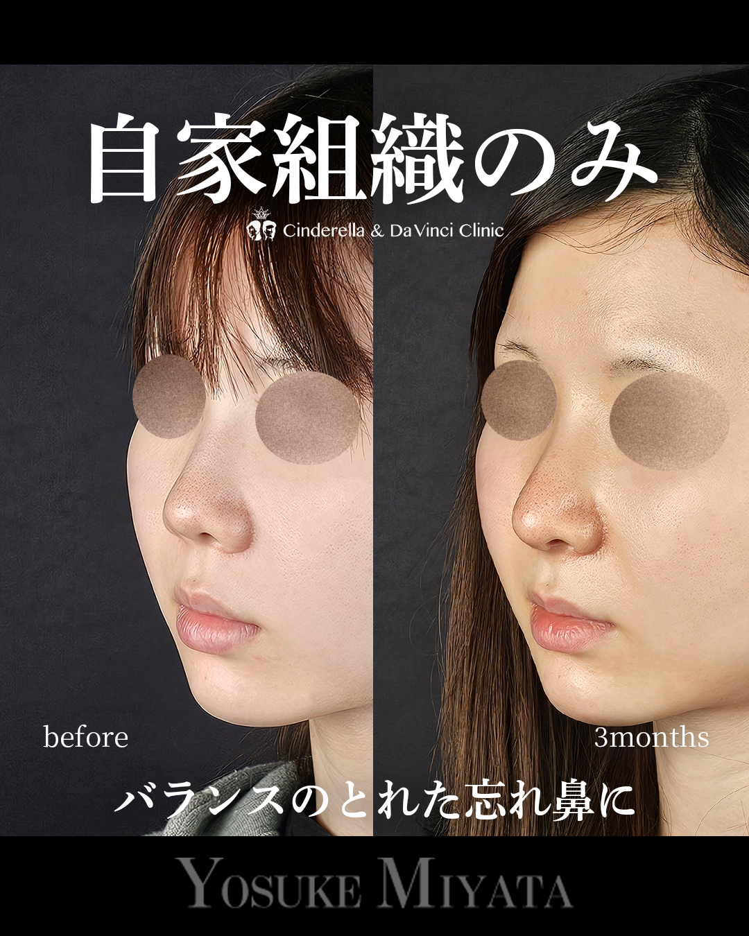 自家組織のみの画像