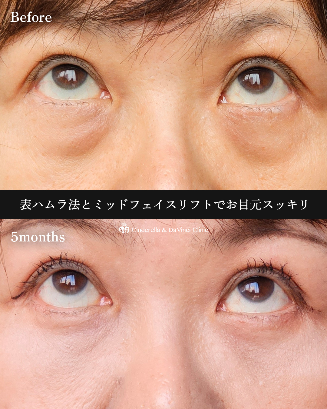 二施術同時の画像