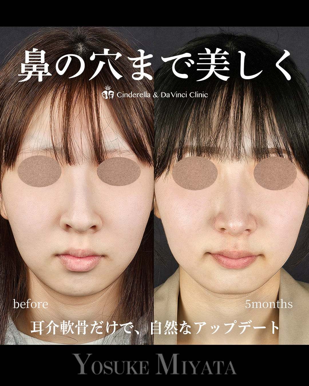 鼻の穴まできれいにの画像