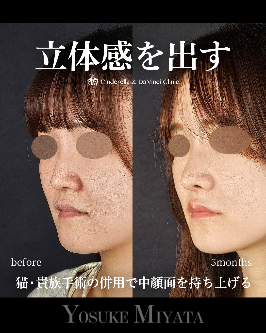 立体感を出すの画像