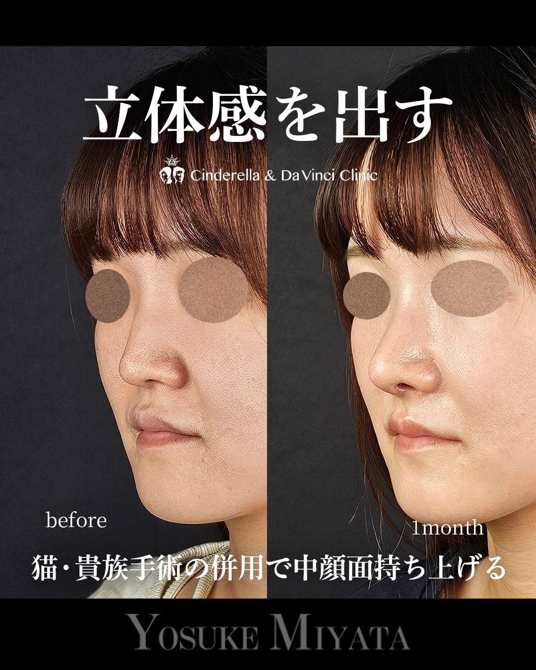 立体感を出すの画像