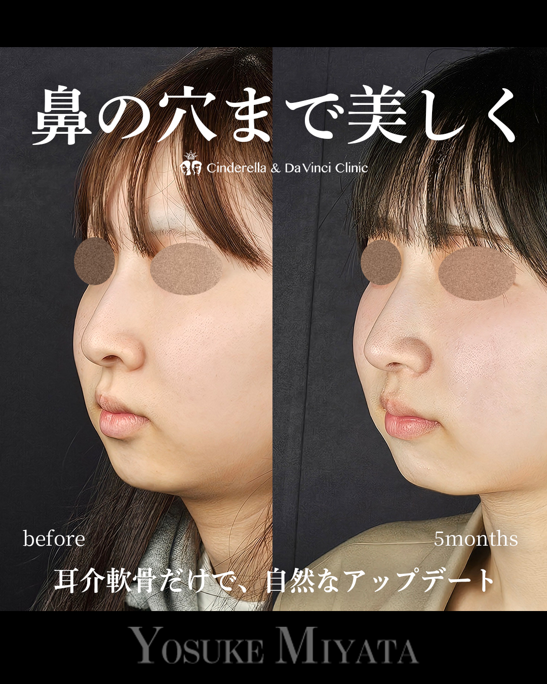 鼻の穴まできれいにの画像